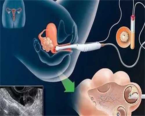 高鹰助孕IVF新突破第四怀孕育卵浆置换试管代孕