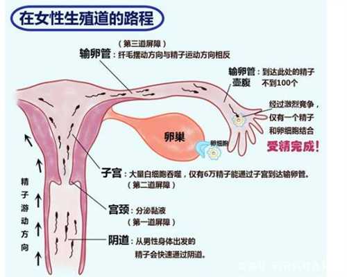 衡阳中国捐卵条件，卵巢囊肿如何调理根治