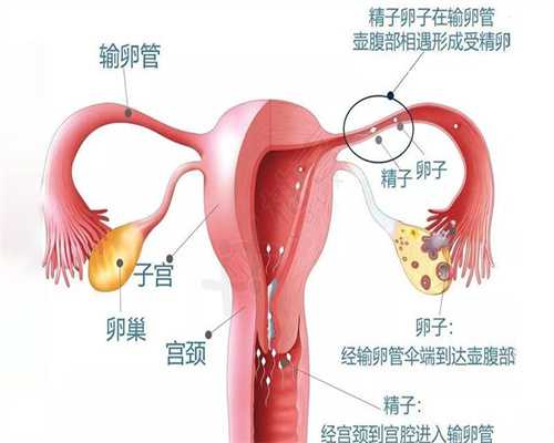 芜湖有偿捐卵群，卵巢衰退怎么治疗