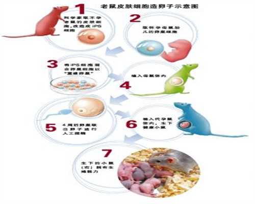 华中大学捐卵，卵巢癌出现腹水是几期
