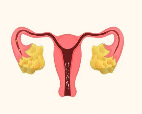 临汾中国能捐卵吗，多囊卵巢怎么补雌激素