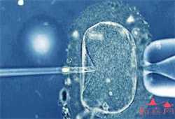 武汉靠谱的代生机构，什么是子宫输卵管造影？
